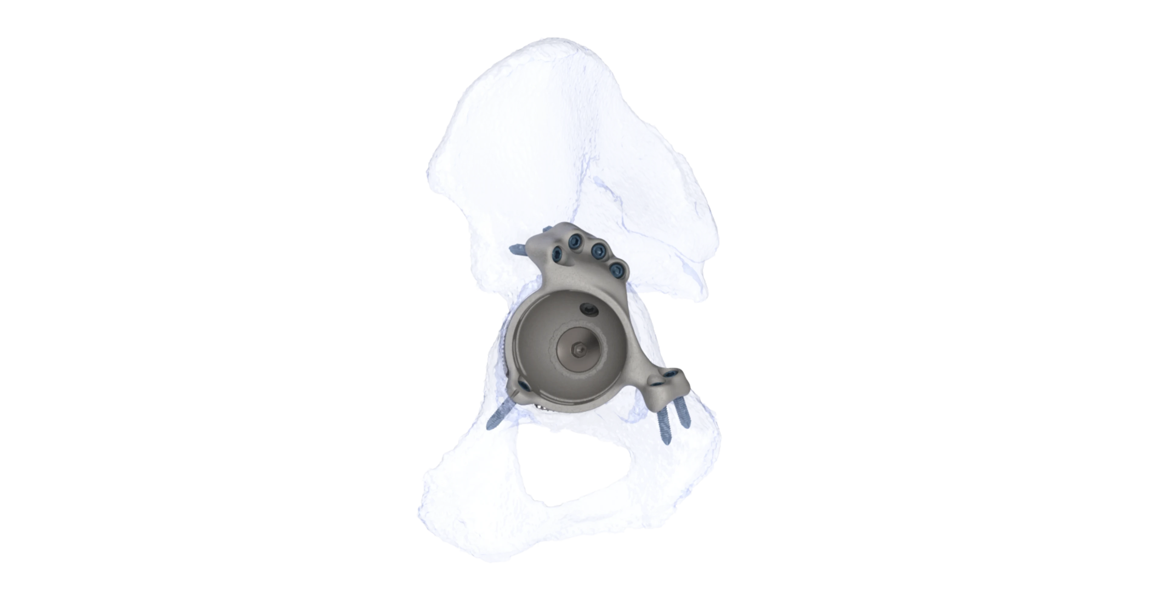 OSSIS Product Page | Main Image