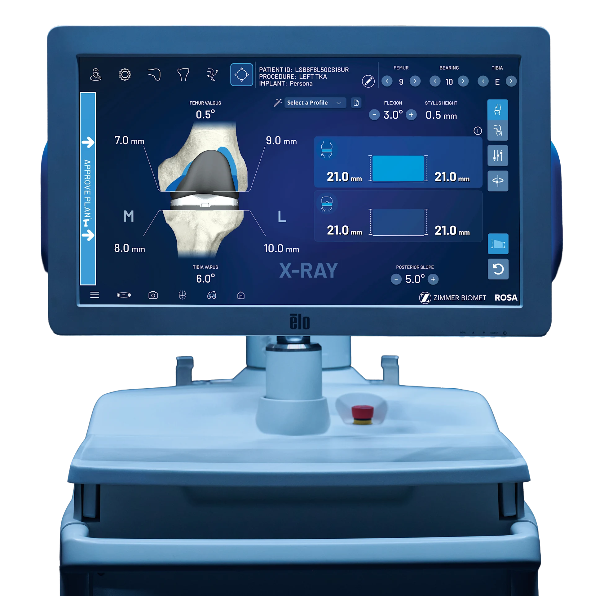 Zimmer Rosa Tibial Array ROSA Knee with OptimiZe System | Zimmer Biomet | Zimmer Biomet