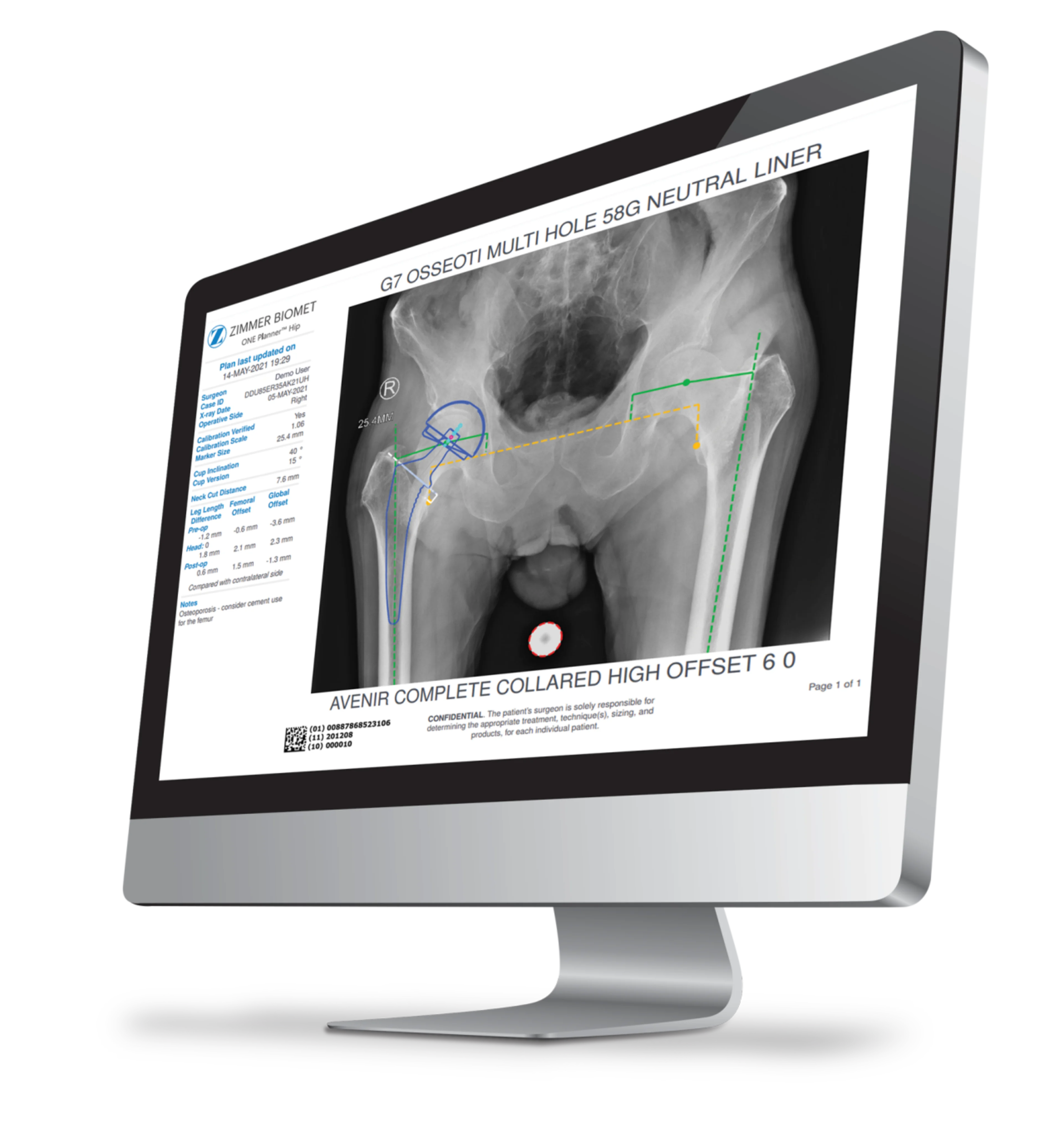 ONE Planner® Hip | Product Page | main Image