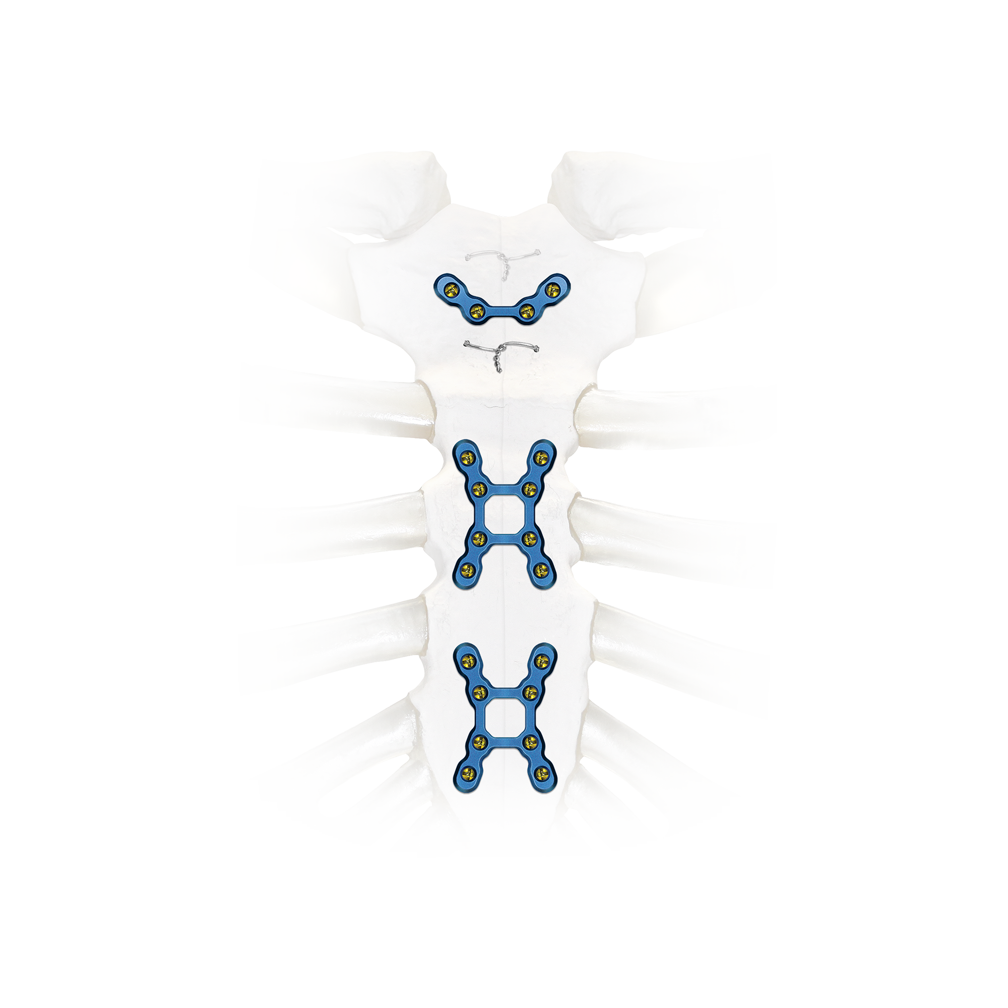 SternaLock Blu | Main Product Image