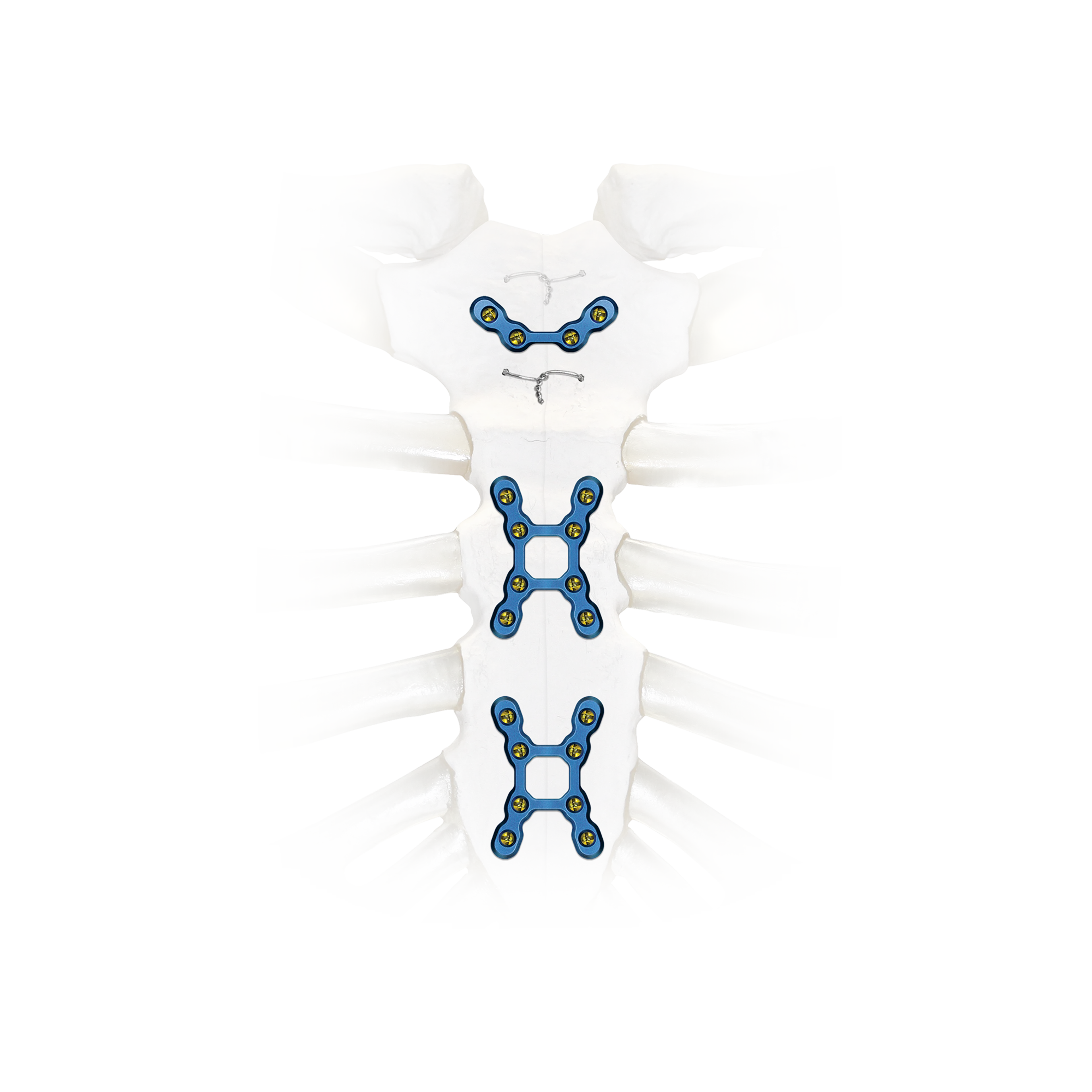 SternaLock Blu | Main Product Image