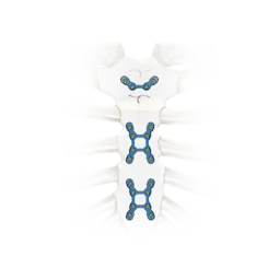 Sternal Lock SternaLock Blu Primary Closure System | Zimmer Biomet | Zimmer Biomet