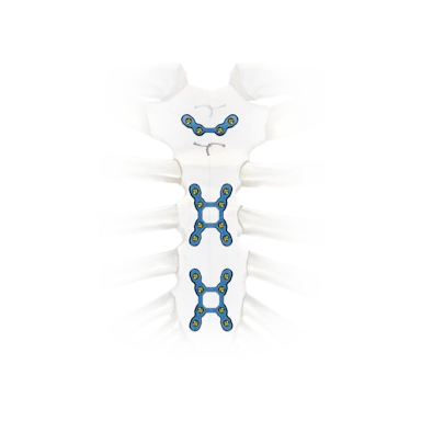 Sternal Lock SternaLock Blu Primary Closure System | Zimmer Biomet | Zimmer Biomet