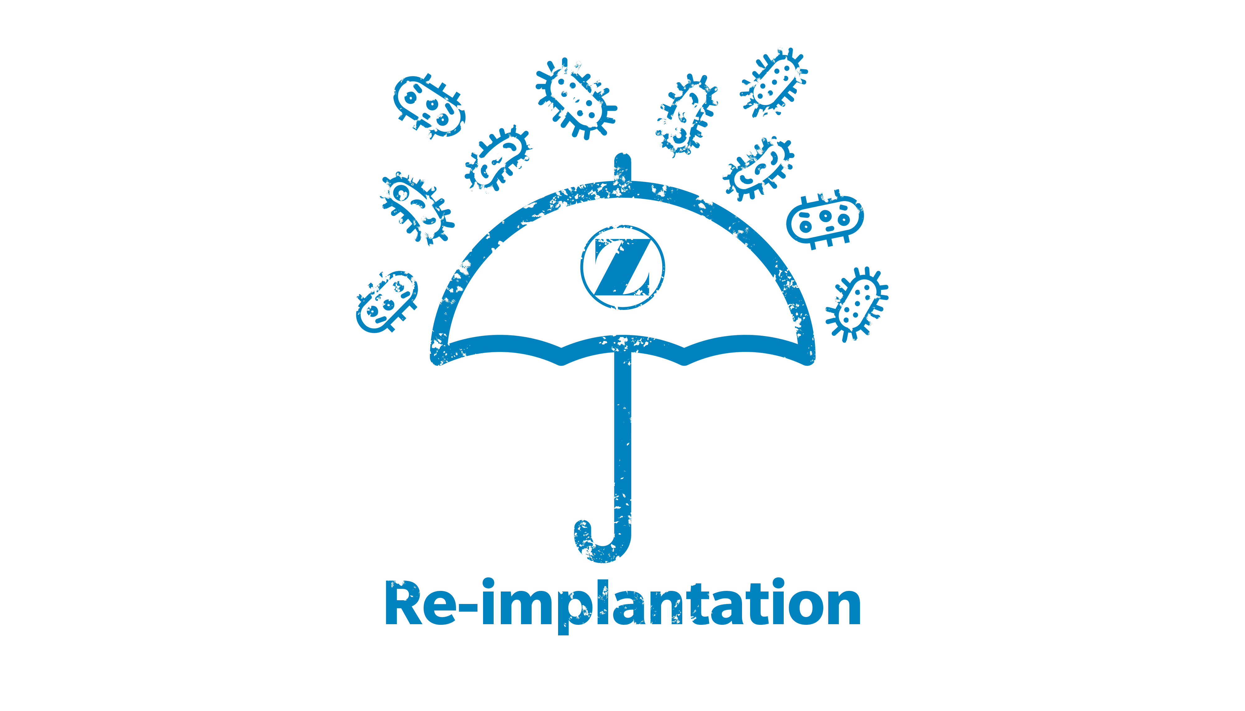 PJI Reimplantation Way Finder Image