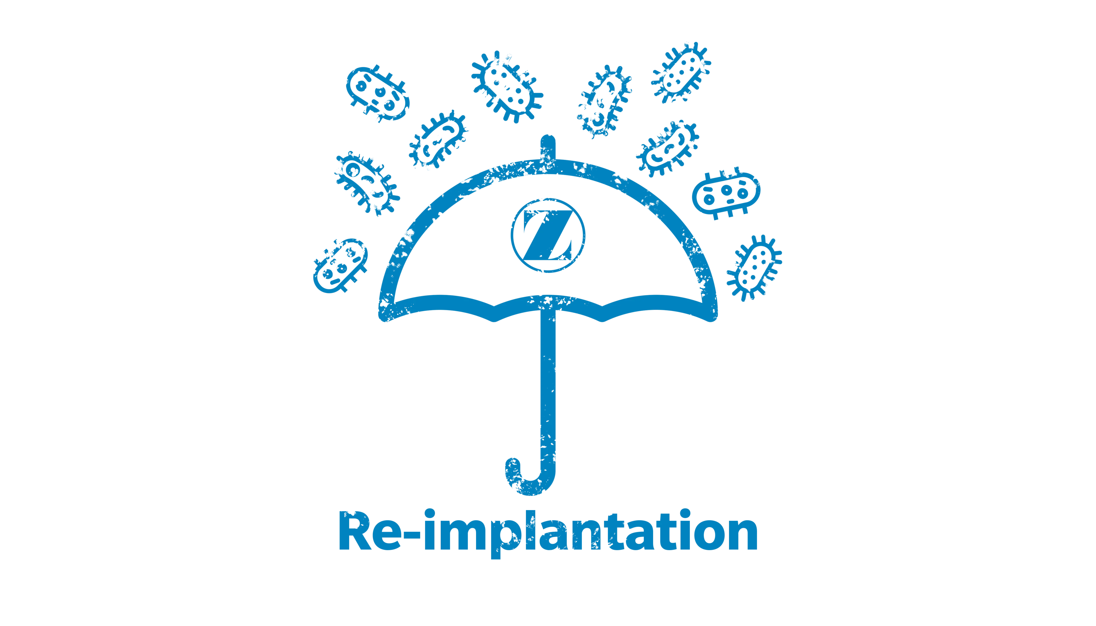PJI Reimplantation Way Finder Image