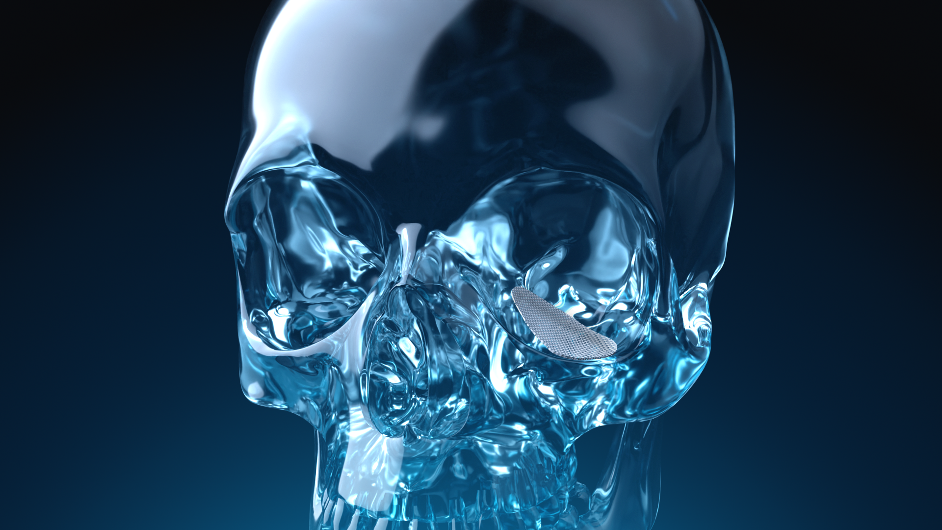 Osteomesh