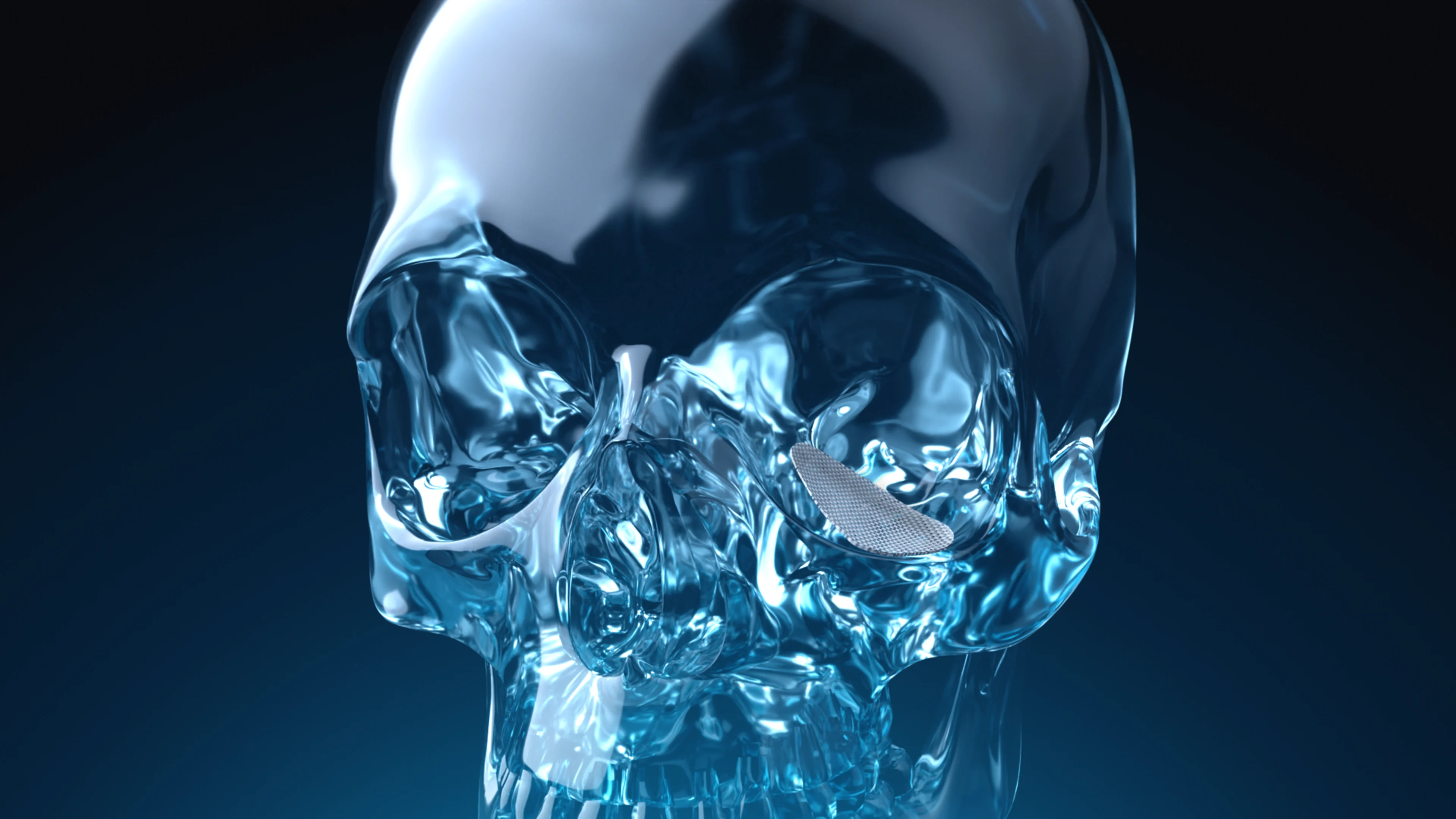 Osteomesh