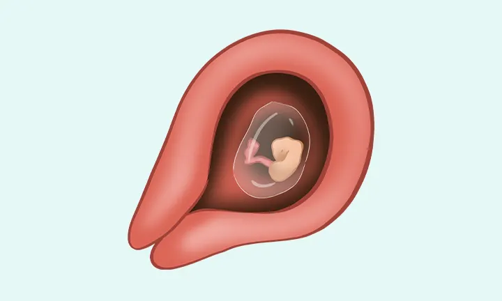 lilla hele Barry 5 tydzień ciąży - objawy i rozwój dziecka | Pampers PL