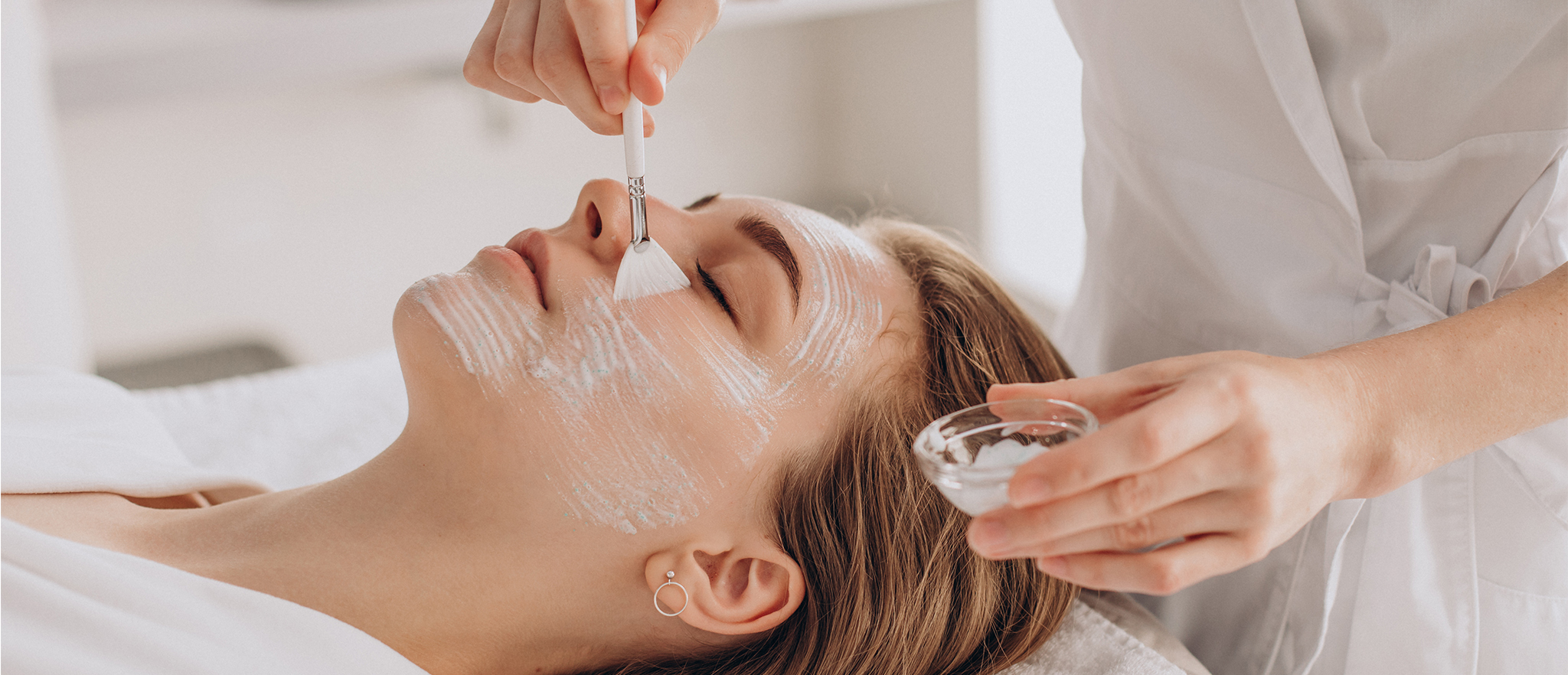 Химичен пилинг