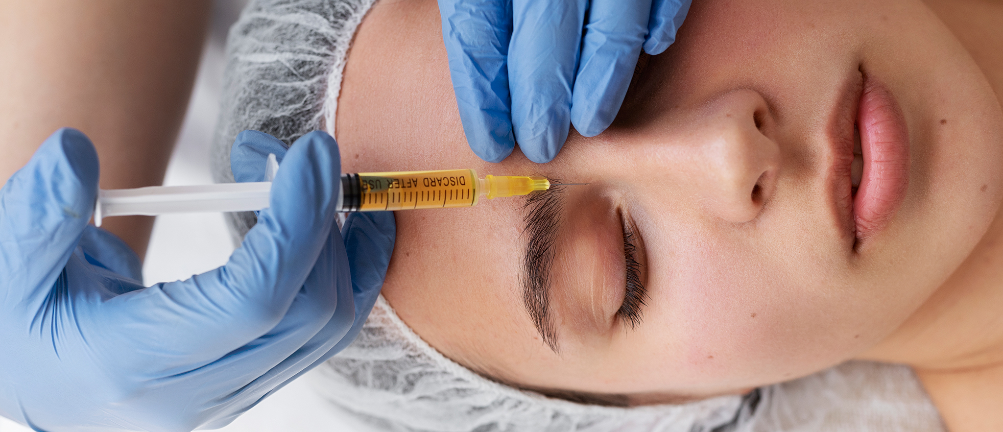 Плазмолифтинг