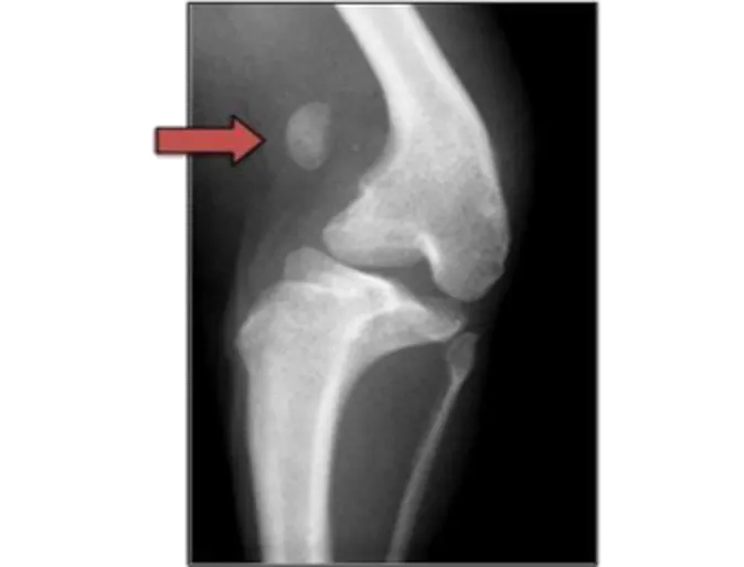 Radiograph of stifle with a grade IV patella luxation Radiograph of stifle with a grade IV patella luxation