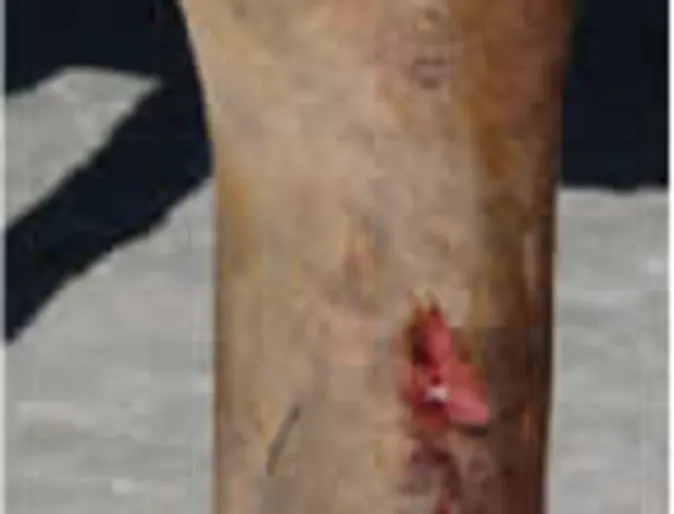 Cappy's leg Cappy's leg