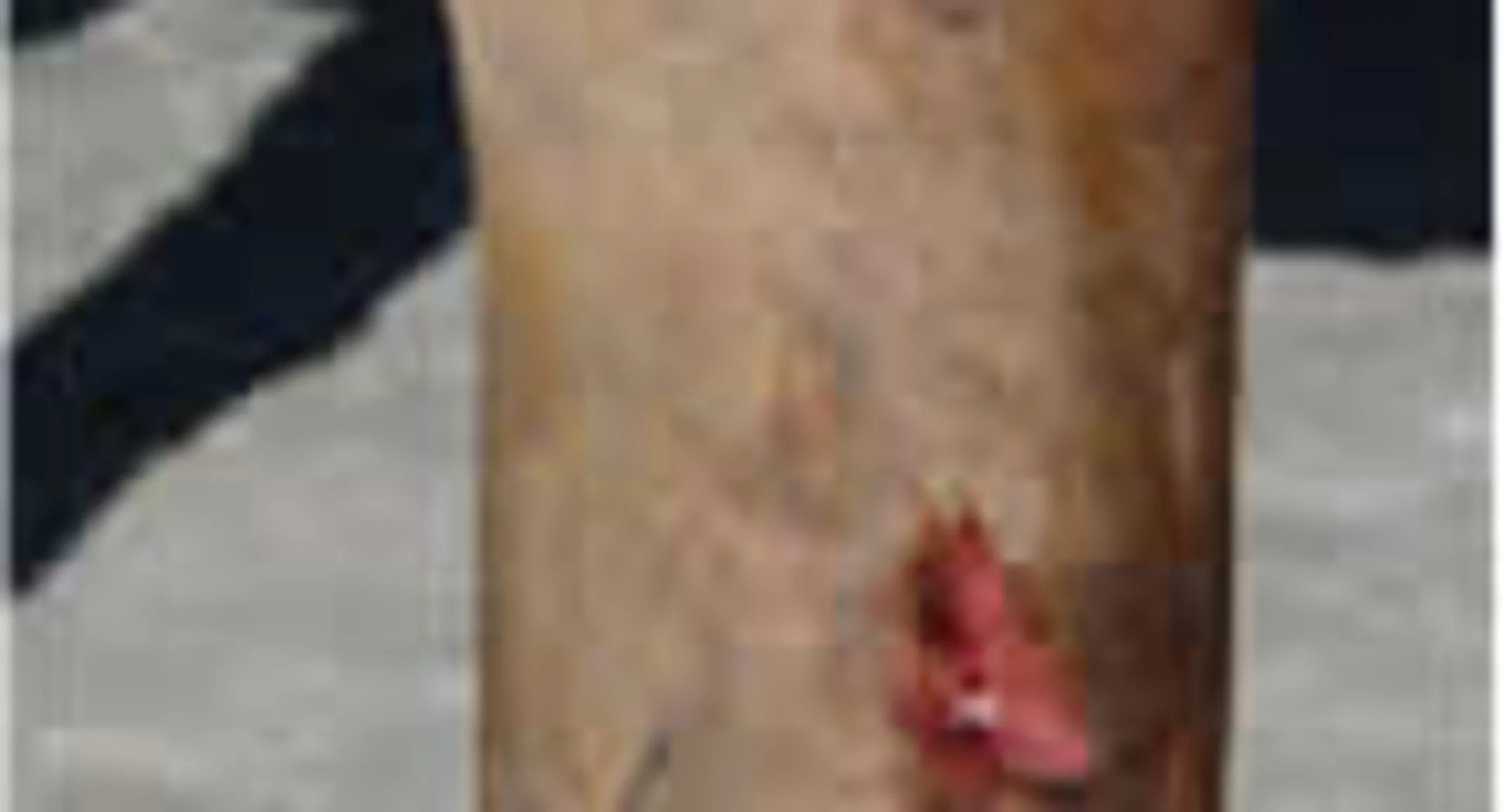 Cappy's leg Cappy's leg
