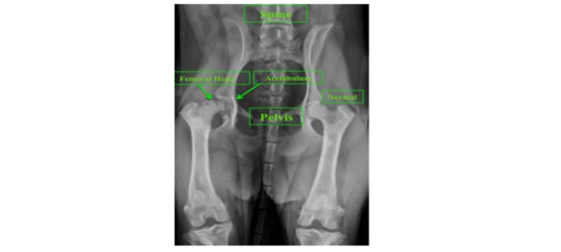 X-Ray of femural head effecting the hips and pelvis on a patient X-Ray of femural head effecting the hips and pelvis on a patient