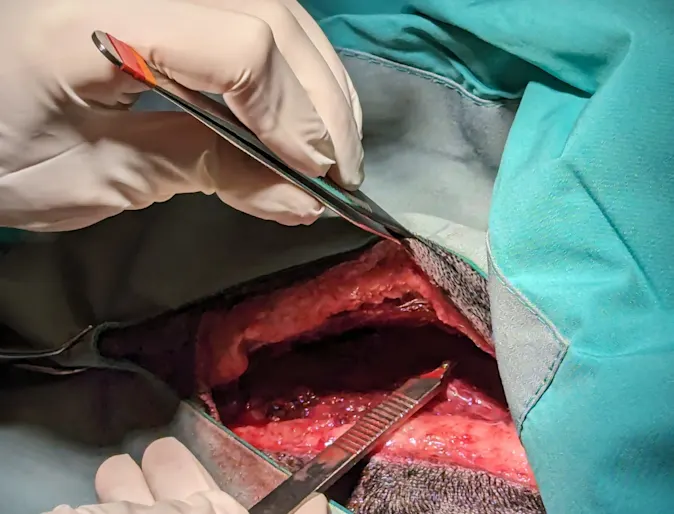 Surgery Surgery