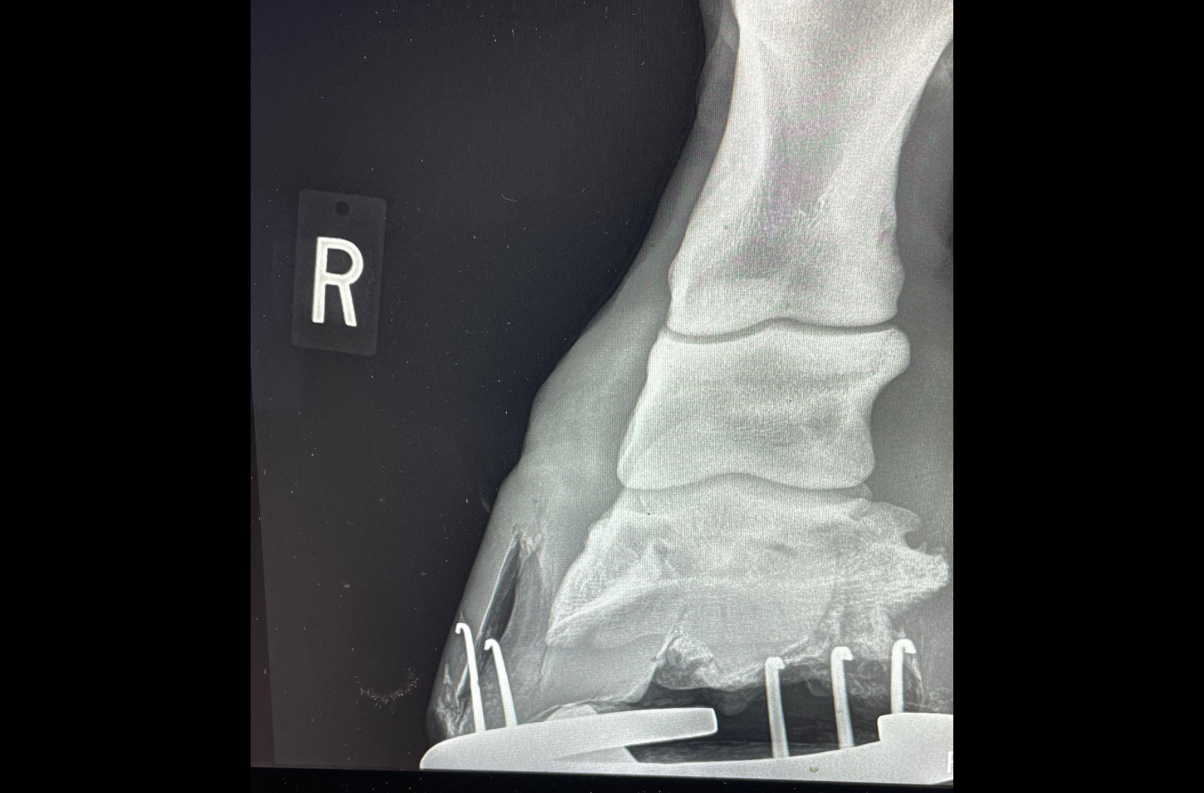 Severe white line disease in a horse's hoof