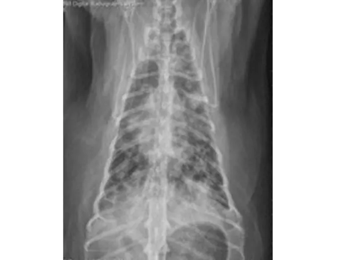 Chest X ray Chest X ray