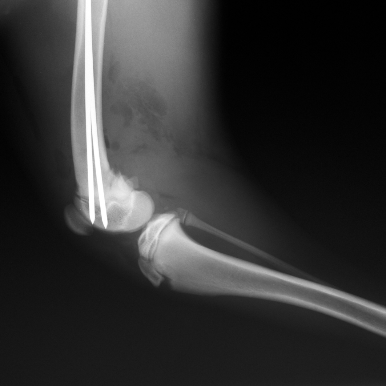 Radiograph Image