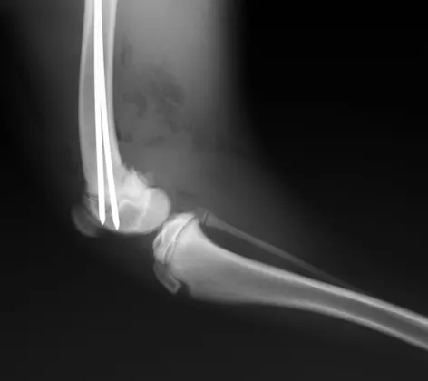 Radiograph Image Radiograph Image