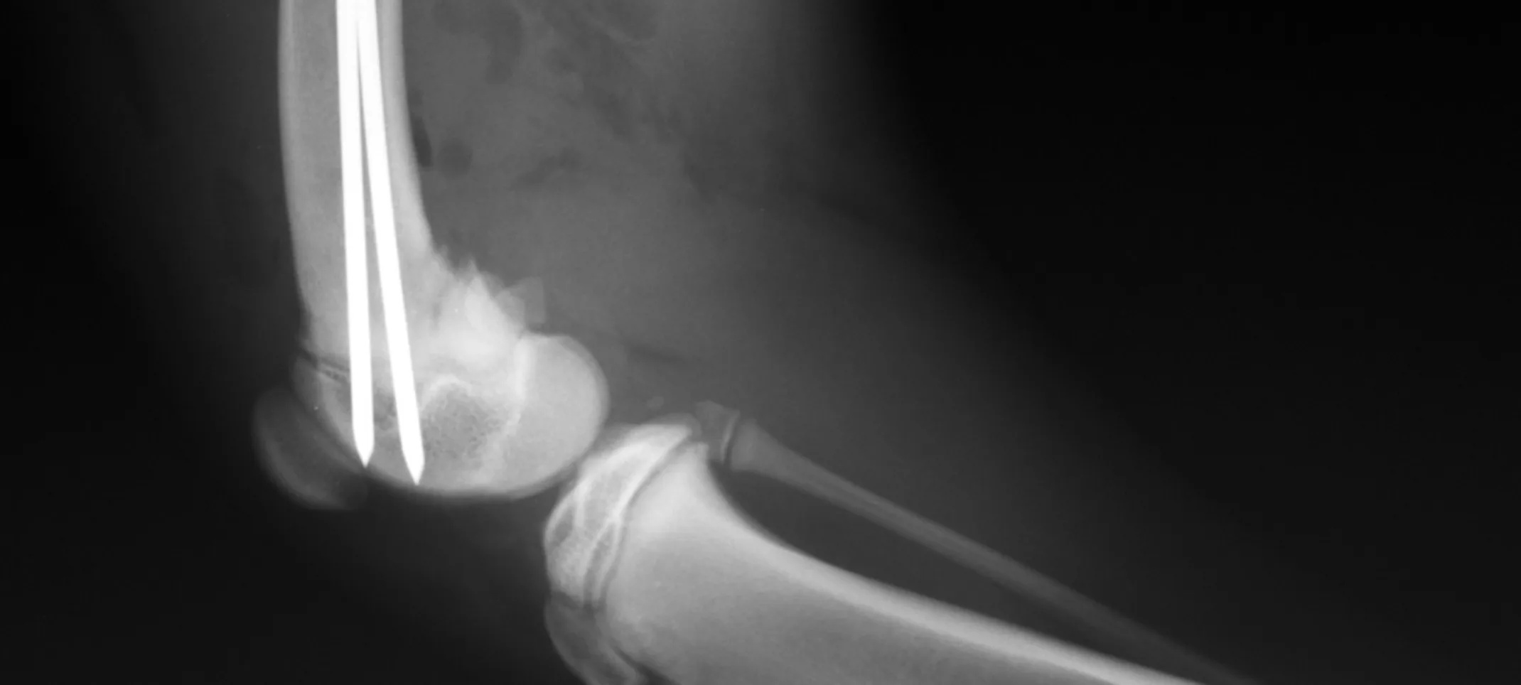 Radiograph Image Radiograph Image