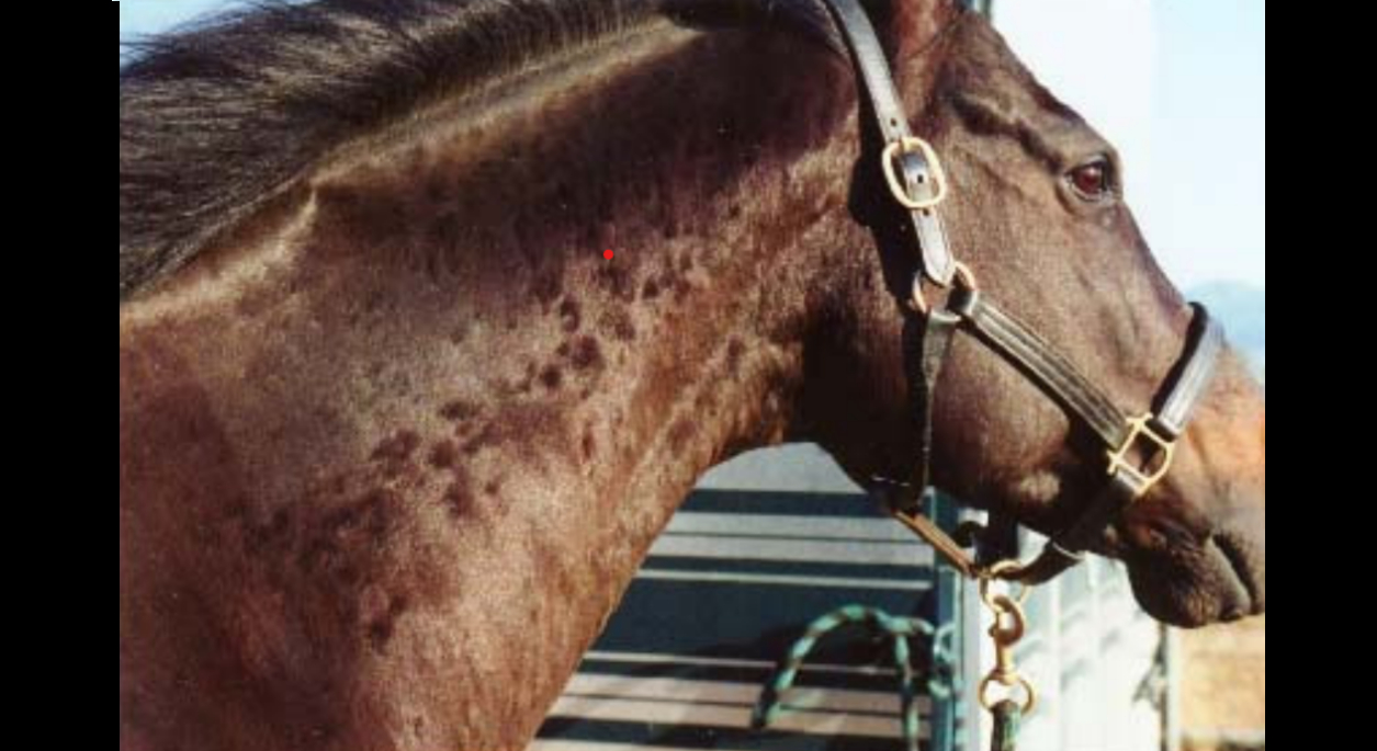 Urticaria (Hives)