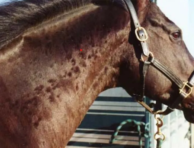 Urticaria (Hives) Urticaria (Hives)