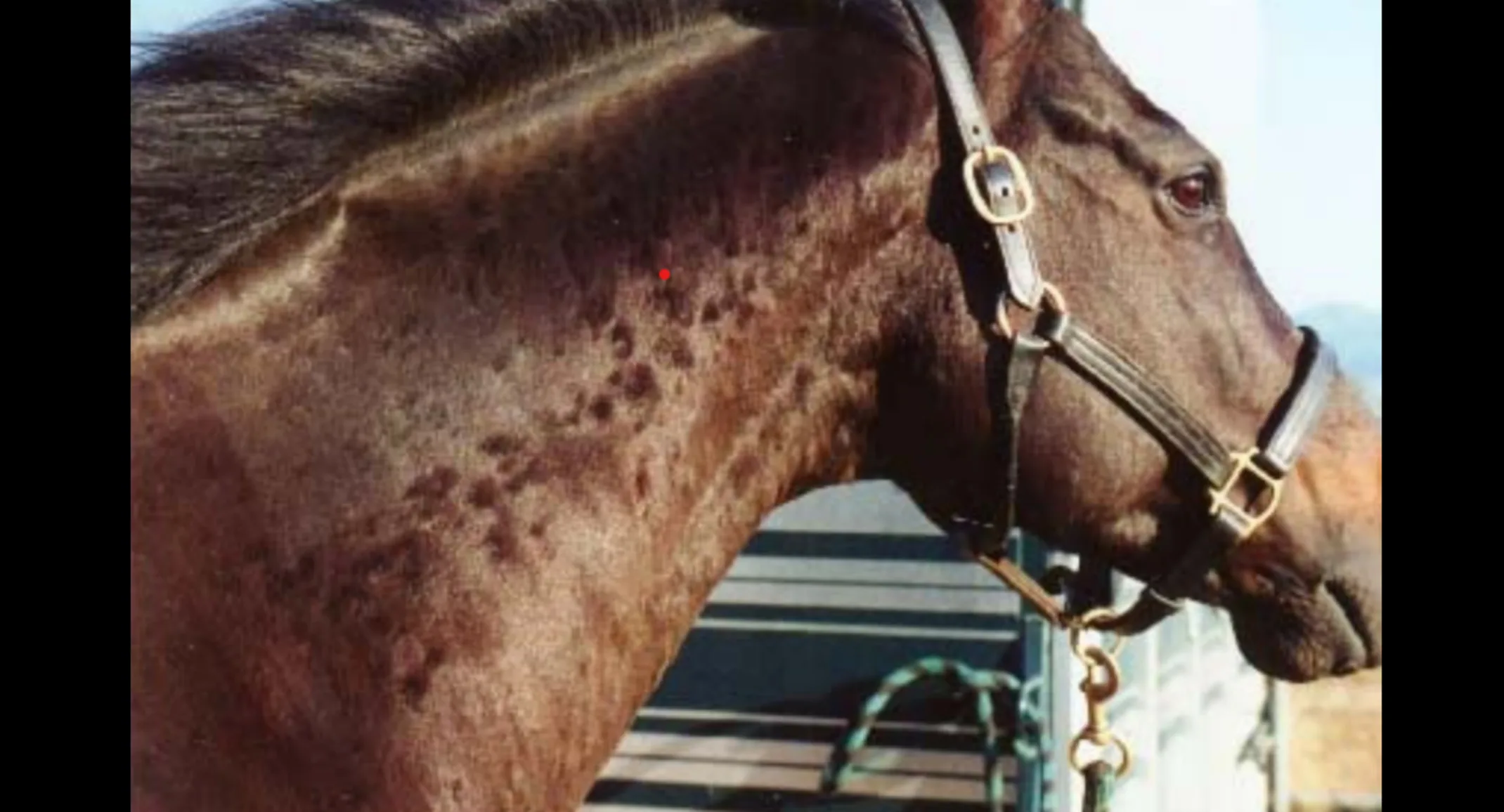 Urticaria (Hives) Urticaria (Hives)