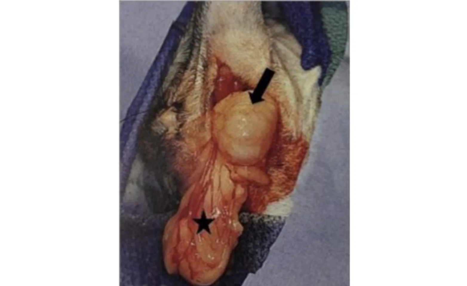 Intraoperative picture of a perineal hernia with a herniated urinary bladder (arrow) and pelvic fat (star) Intraoperative picture of a perineal hernia with a herniated urinary bladder (arrow) and pelvic fat (star)