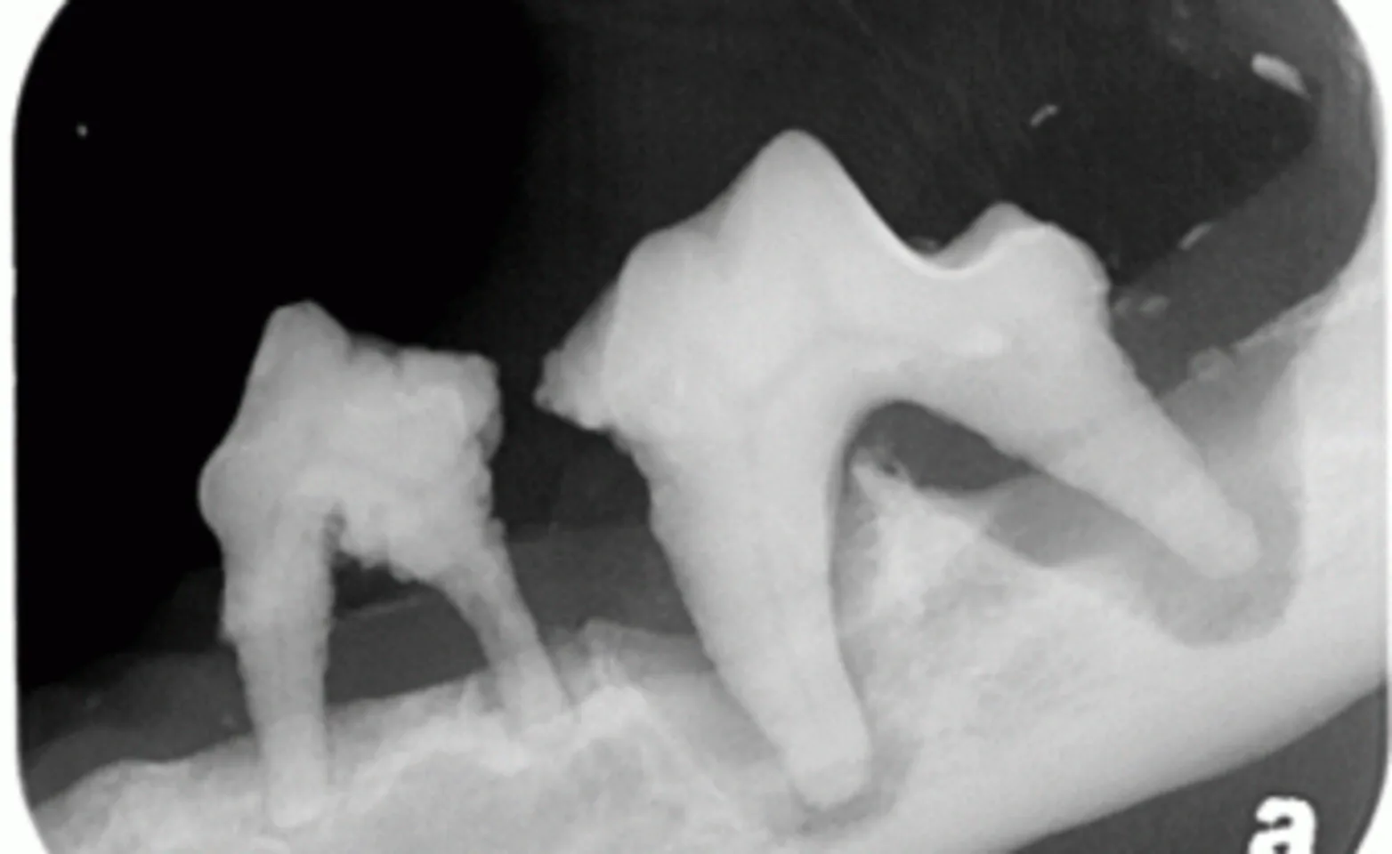 X-ray of canine teeth X-ray of canine teeth