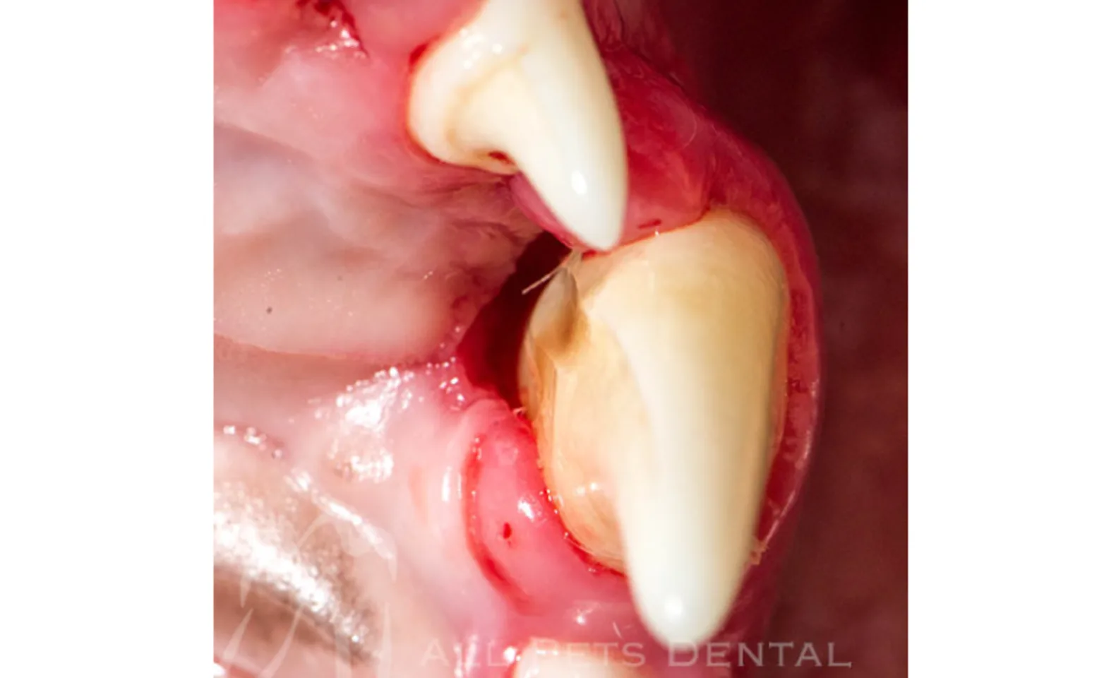 Example of Attachment Loss Example of Attachment Loss