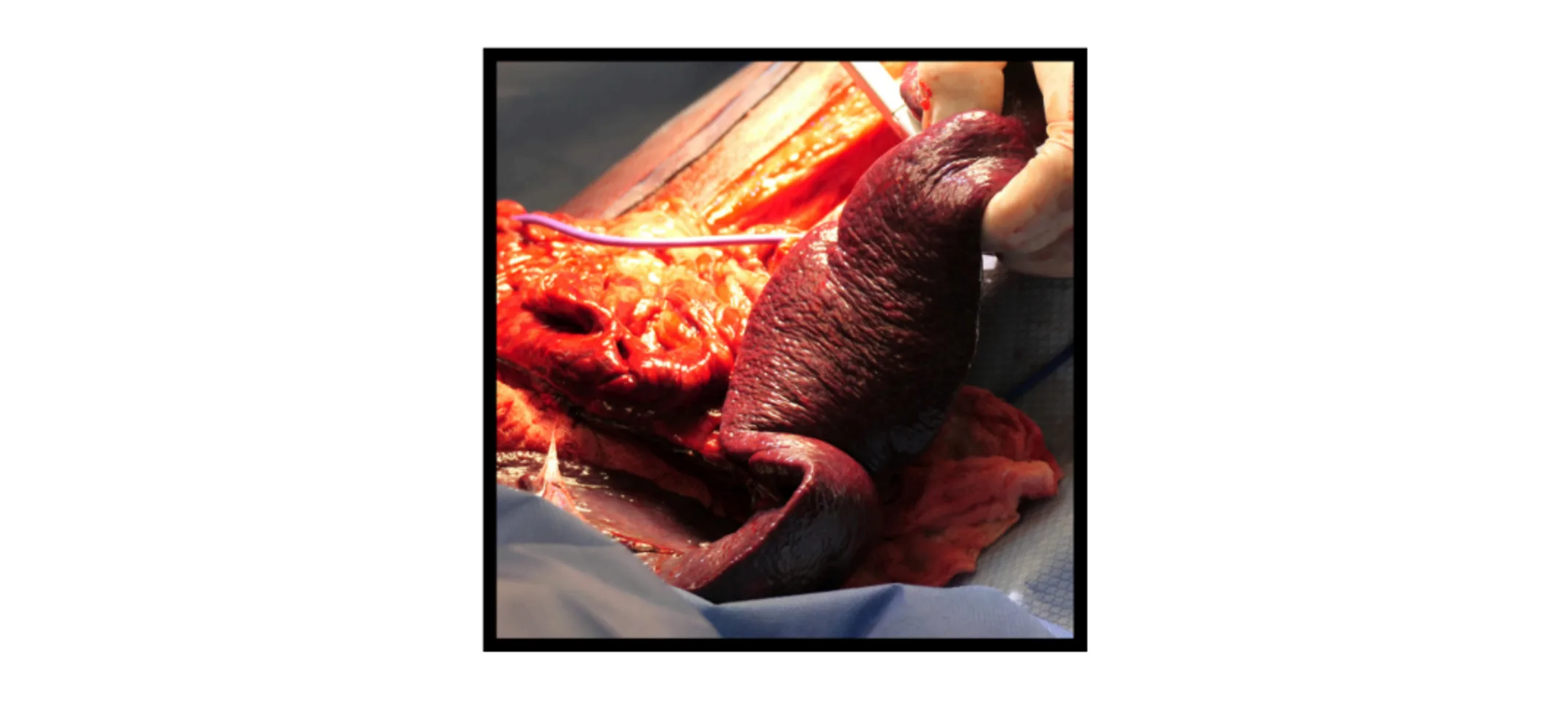 Riggins' Surgery Riggins' Surgery