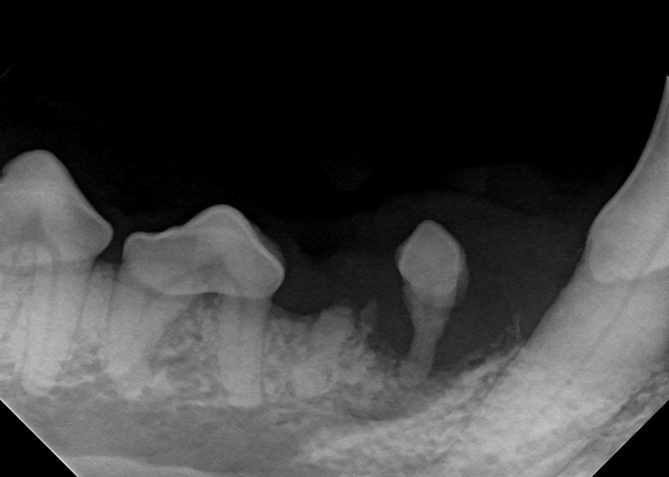 The small, single rooted tooth in this image has 90% bone loss and the root is also disease but on visual exam looks normal.