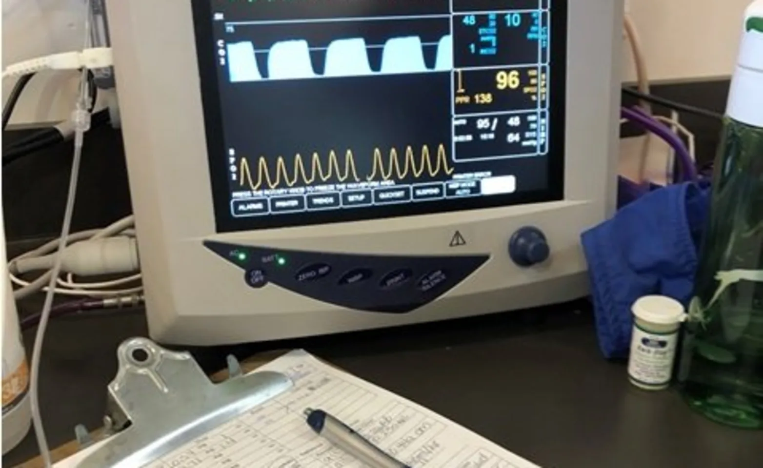Monitoring machine Monitoring machine