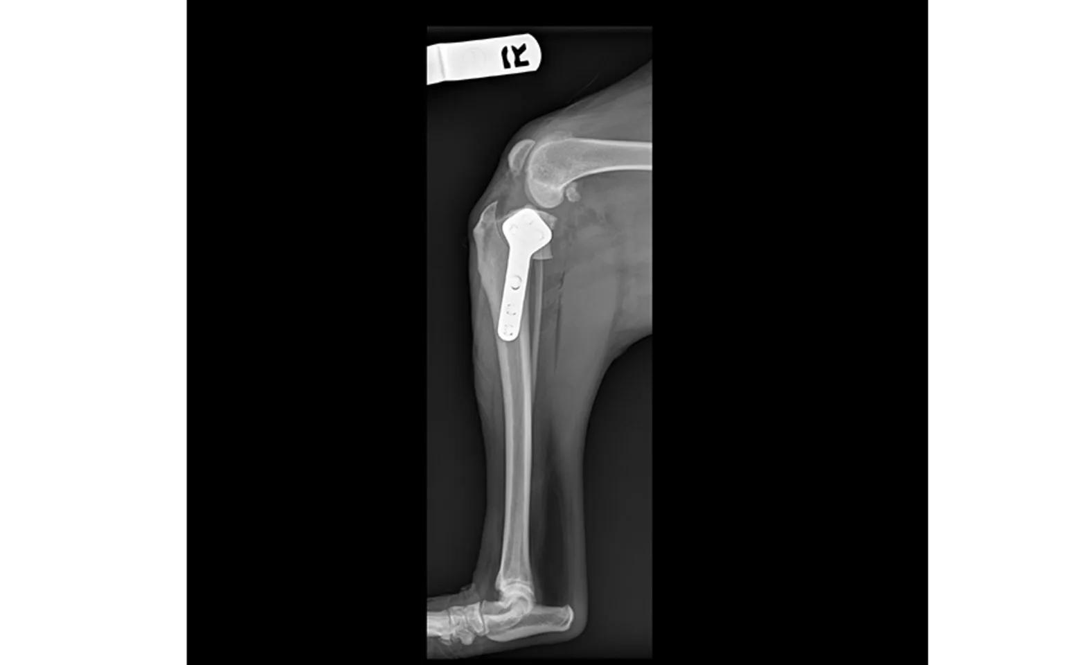Tibial Plateau Leveling Osteotomy (TPLO) X-Ray Tibial Plateau Leveling Osteotomy (TPLO) X-Ray