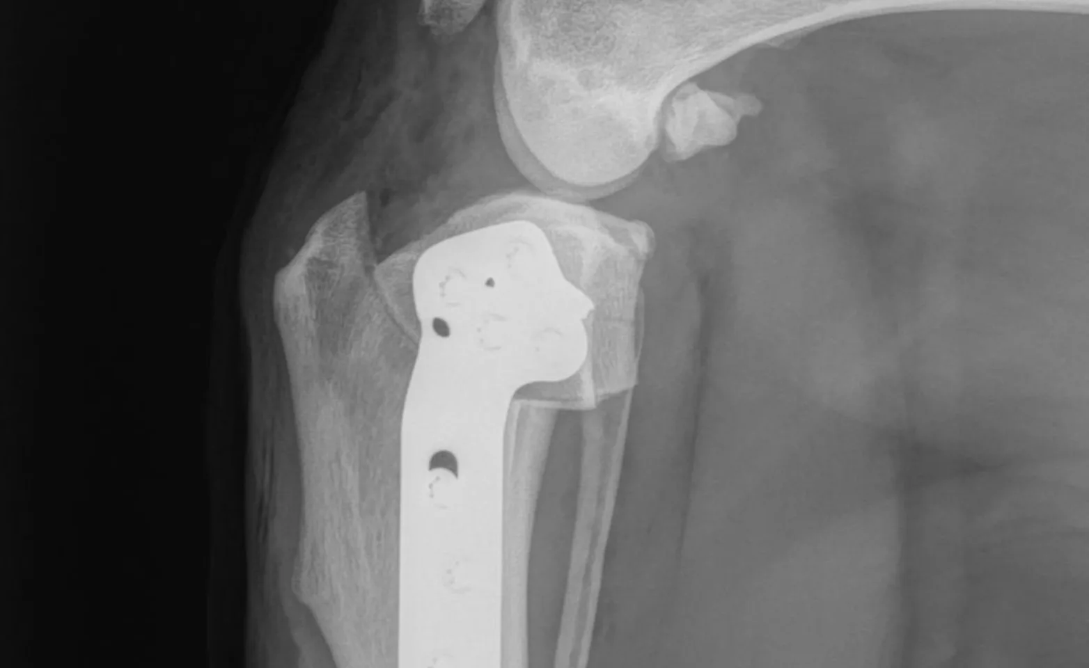 X-ray of joint X-ray of joint