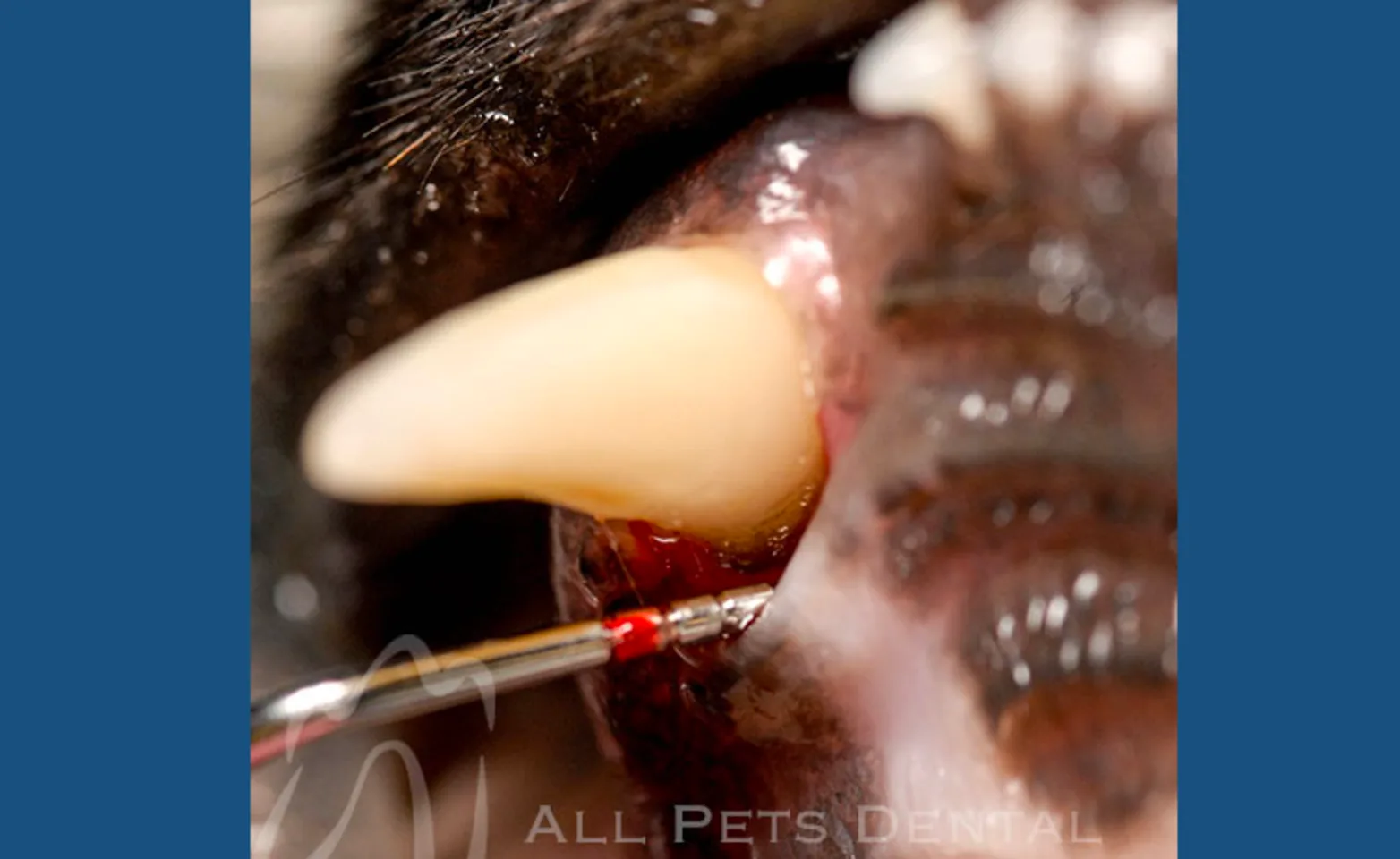 Buccal Defect Buccal Defect