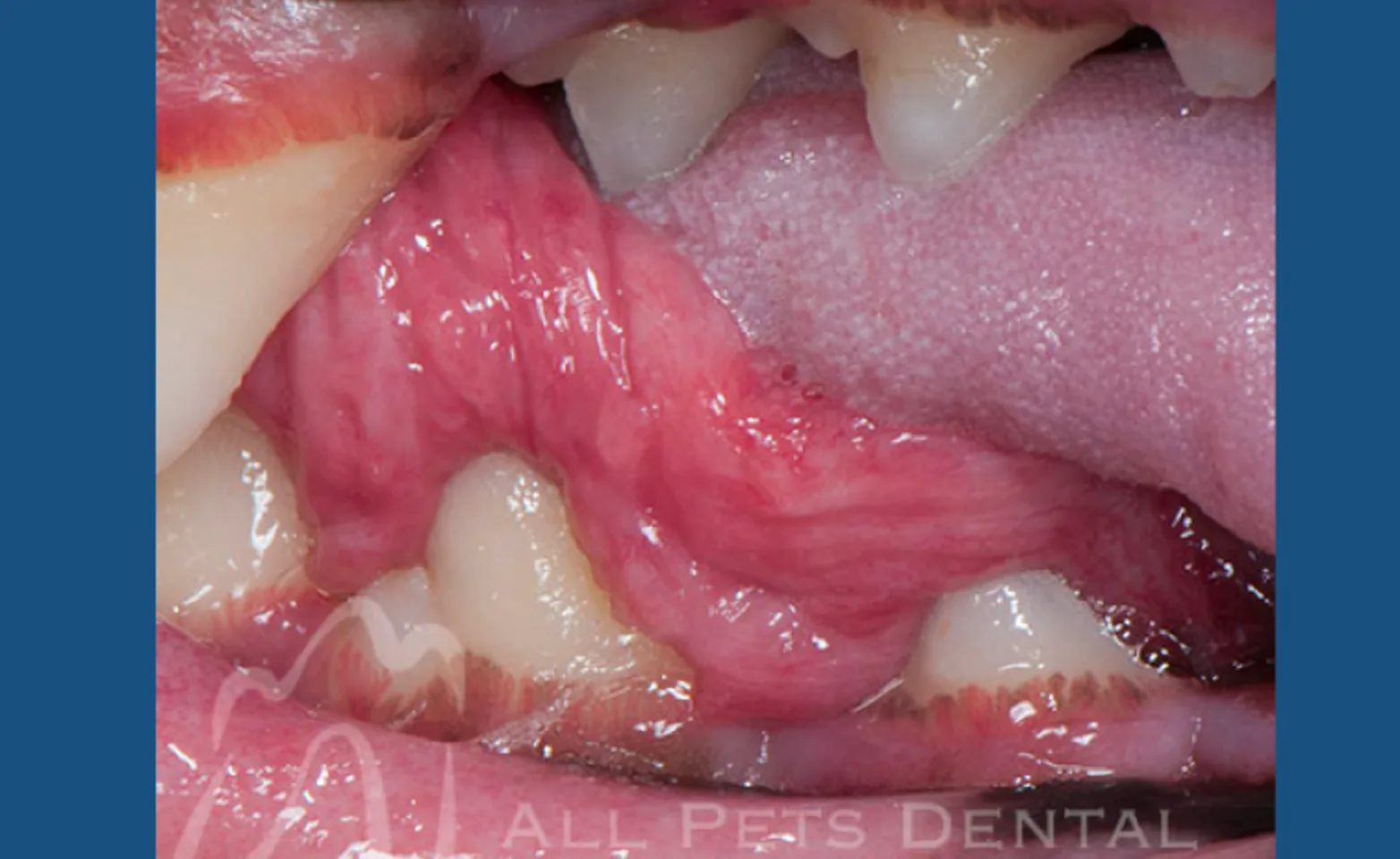 Viral Papilloma Viral Papilloma