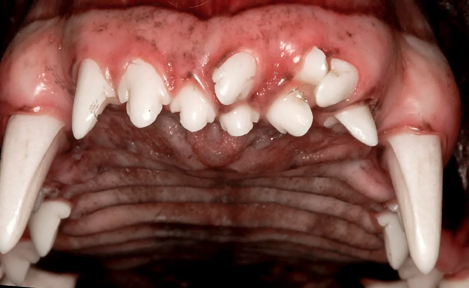 Supernumerary Teeth Supernumerary Teeth