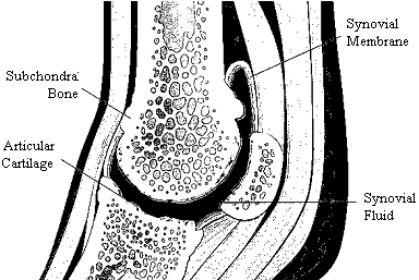 Degenerative Joint Disease Illustration