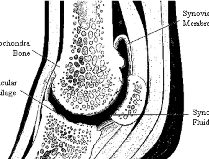 Degenerative Joint Disease Illustration Degenerative Joint Disease Illustration