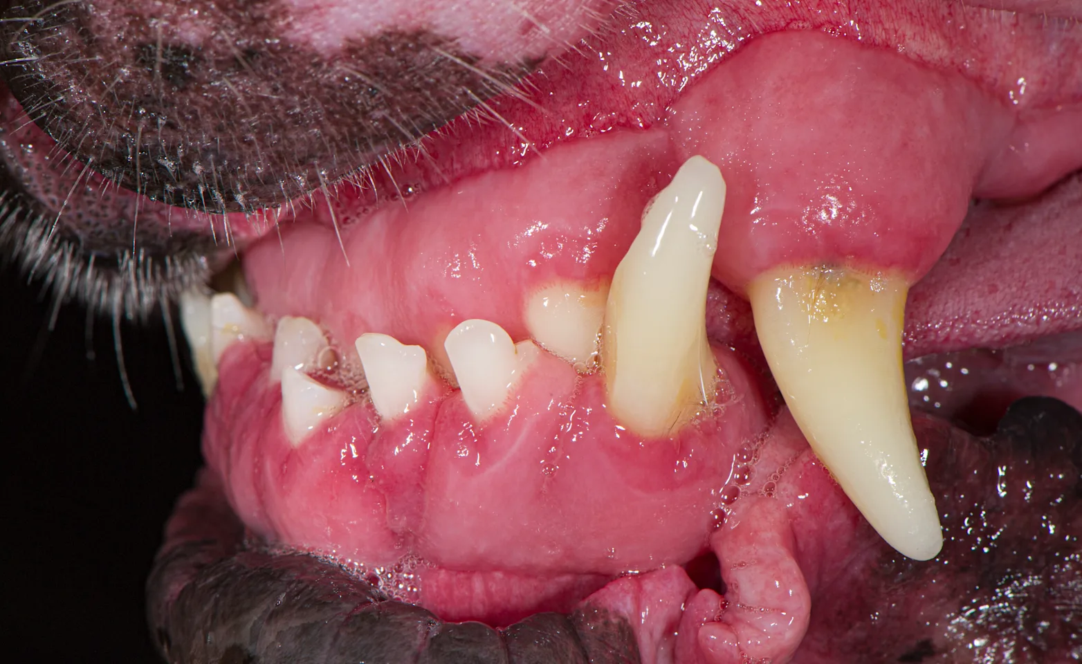 Mandibular Mesioclusion Mandibular Mesioclusion