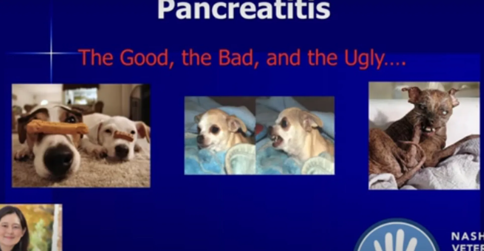 Pancreatitis Video