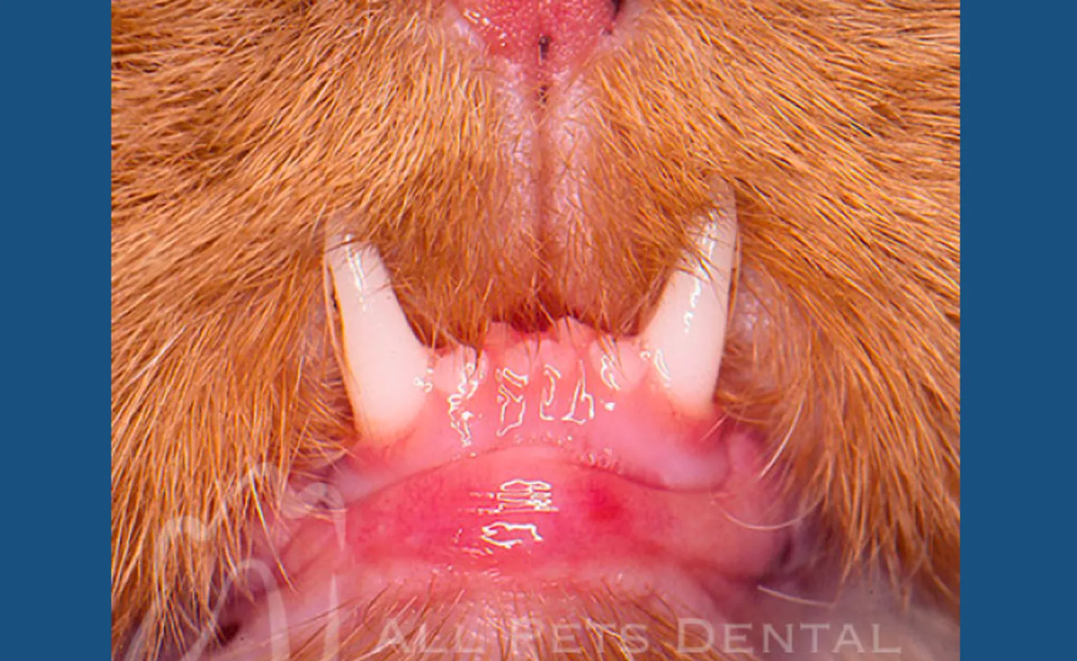 Under Bite Under Bite