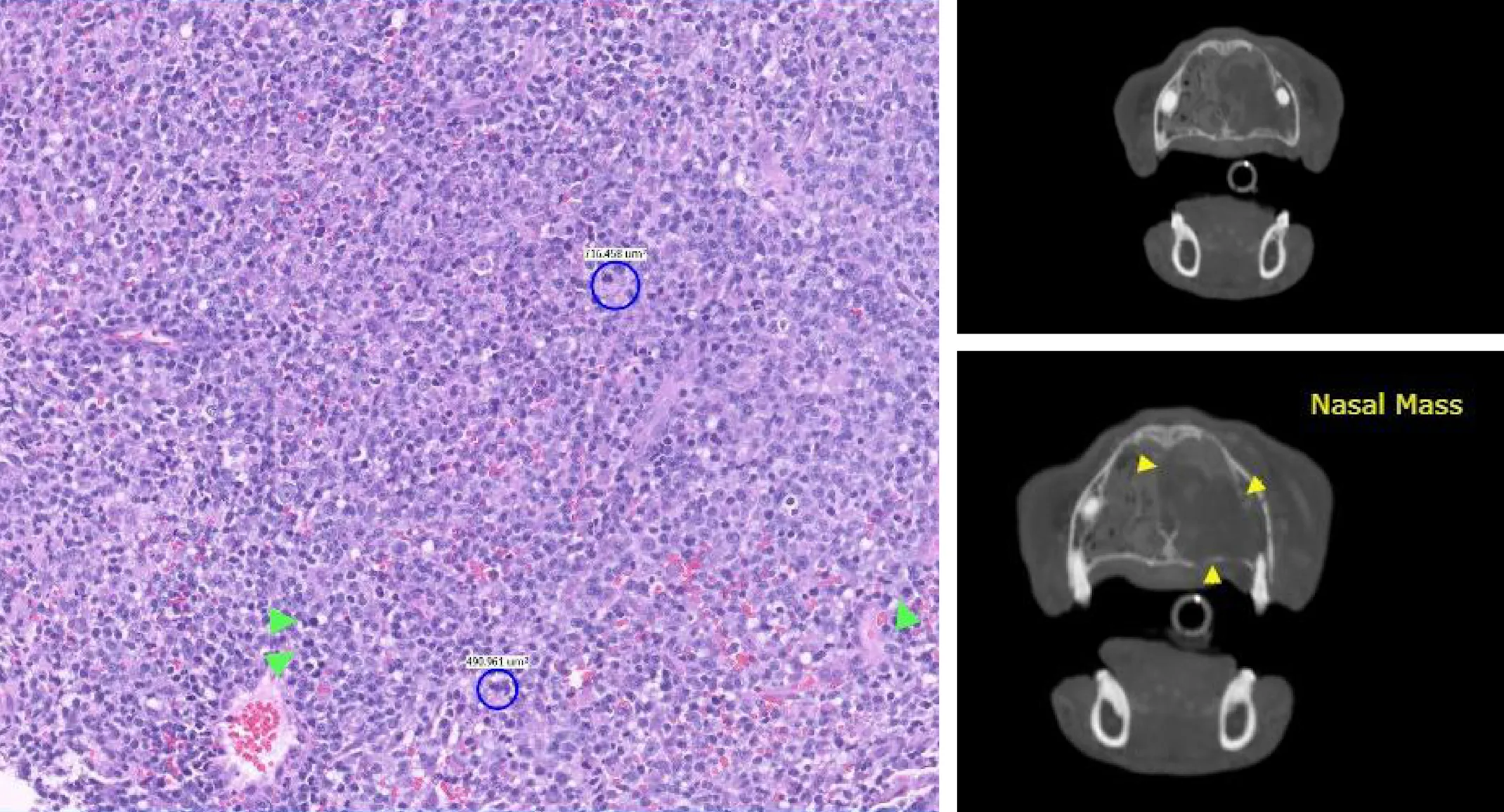 3 images of CT 3 images of CT