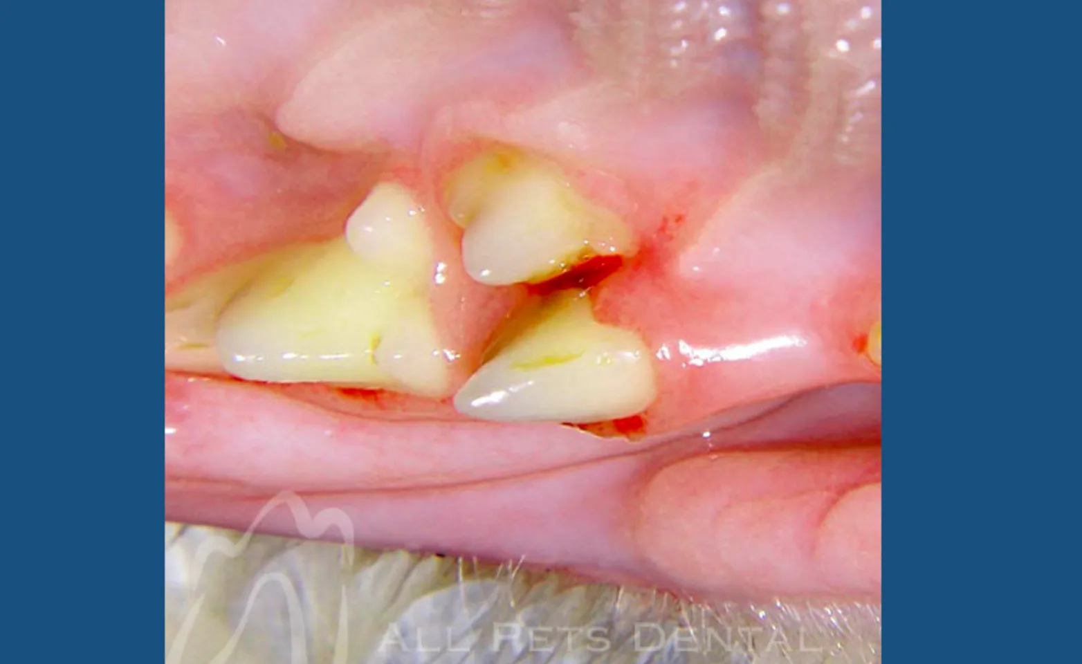 Supernumerary Teeth Supernumerary Teeth