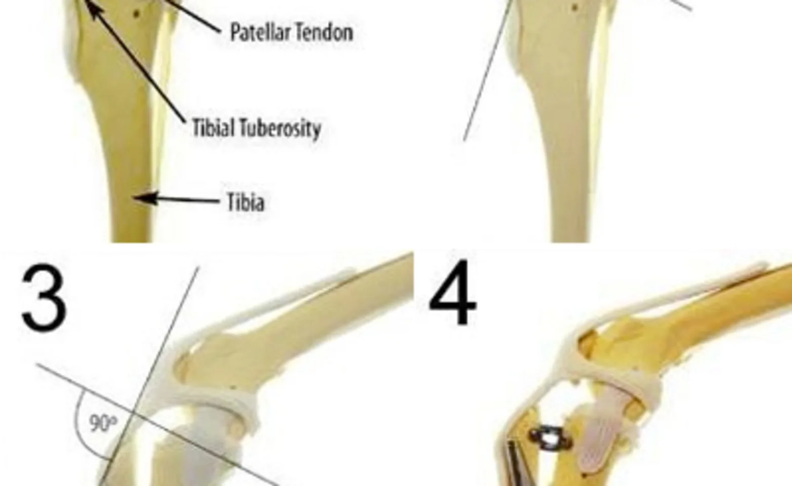Section of knee diagram Section of knee diagram