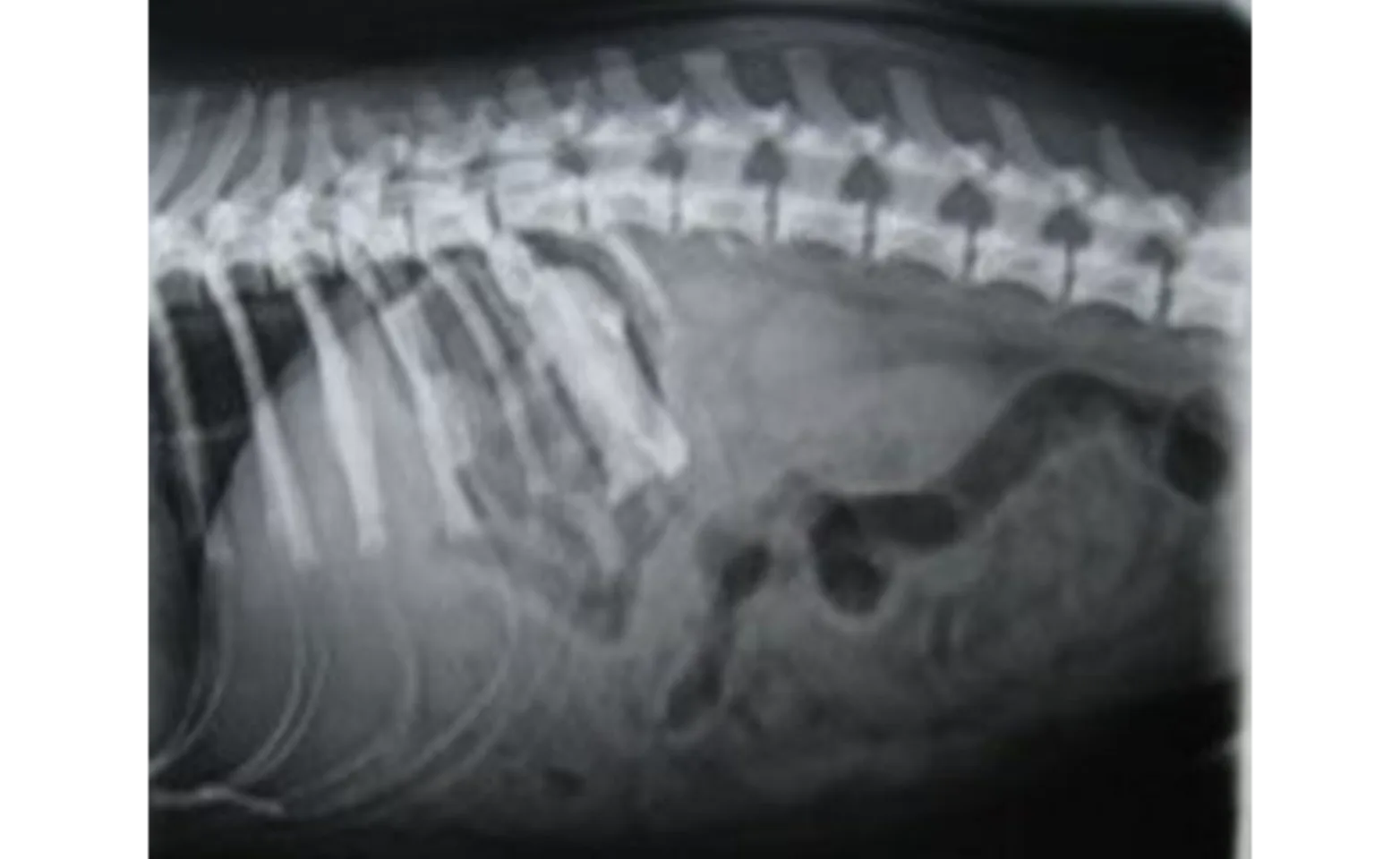 Abdominal radiograph Abdominal radiograph