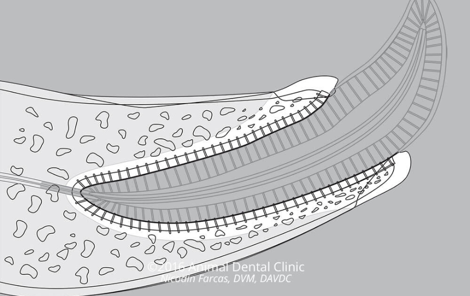 B&W diagram of a tooth
