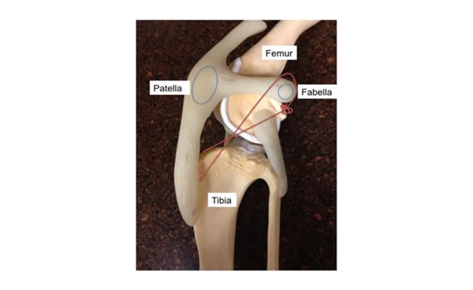Figure 1 - Stifle (Knee) Anatomy Figure 1 - Stifle (Knee) Anatomy