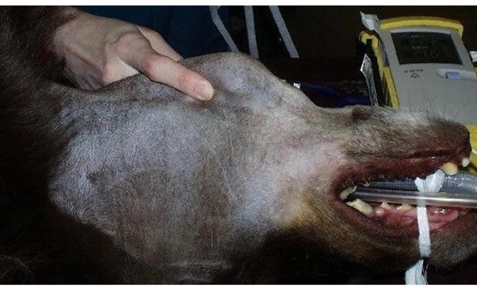 Cervical Sialocele Cervical Sialocele